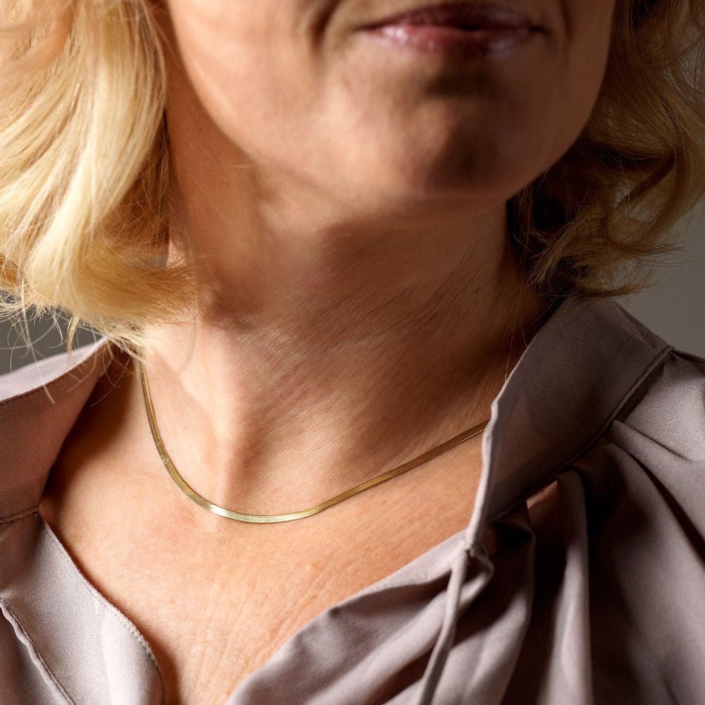 Halsketting Blomdahl chirurgisch staal plain goudkleurig